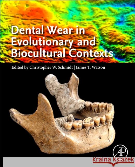 Dental Wear in Evolutionary and Biocultural Contexts Christopher W. Schmidt James T. Watson 9780128155998