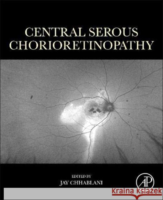 Central Serous Chorioretinopathy Jay Chhablani 9780128168004