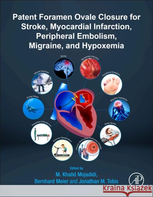 Patent Foramen Ovale Closure for Stroke, Myocardial Infarction, Peripheral Embolism, Migraine, and Hypoxemia Mojadidi, M. Khalid 9780128169667 Academic Press