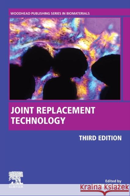 Joint Replacement Technology Peter A. Revell 9780128210826 Woodhead Publishing