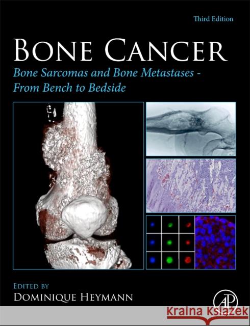 Bone Cancer: Bone Sarcomas and Bone Metastases From Bench to Bedside  9780128216668 Academic Press