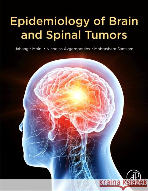 Epidemiology of Brain and Spinal Tumors Jahangir Moini Nicholas G. Avgeropoulos Mohtashem Samsam 9780128217368 Academic Press