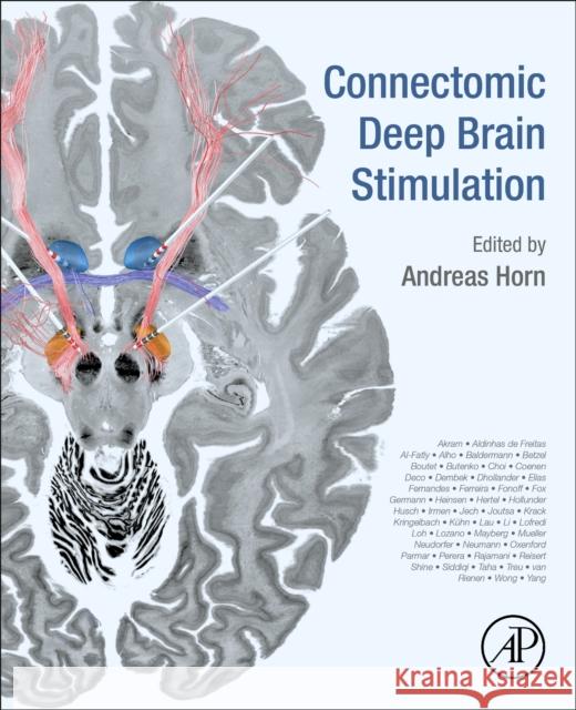 Connectomic Deep Brain Stimulation Andreas Horn 9780128218617 Academic Press