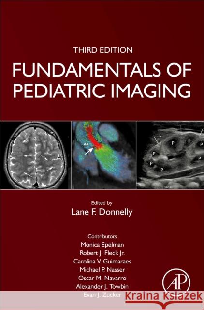 Fundamentals of Pediatric Imaging Lane F. Donnelly 9780128222553 Academic Press