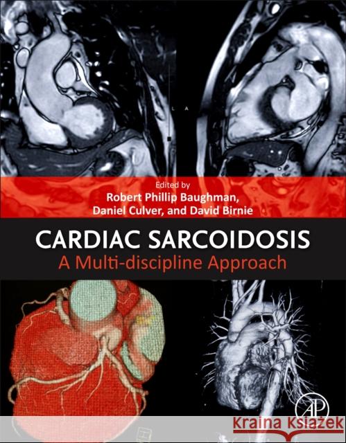 Cardiac Sarcoidosis: A Multi-discipline Approach  9780128223321 Academic Press