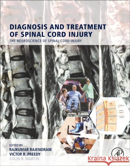 Diagnosis and Treatment of Spinal Cord Injury Rajkumar Rajendram Victor R. Preedy Colin R. Martin 9780128224984 Academic Press