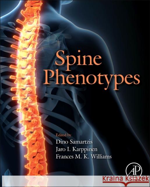 Spine Phenotypes Dino Samartzis Jaro Ilari Karppinen Frances Mary Kingsley Williams 9780128227787