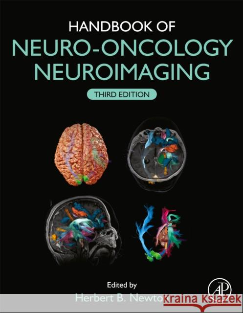 Handbook of Neuro-Oncology Neuroimaging Herbert B. Newton 9780128228357