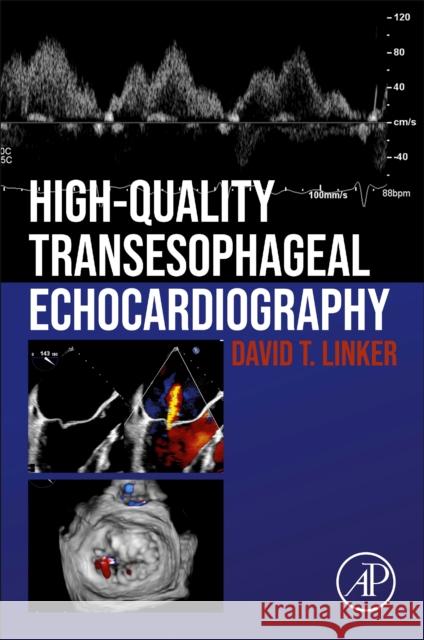 High Quality Transoesophageal Echocardiography David T. Linker 9780128229323 Academic Press