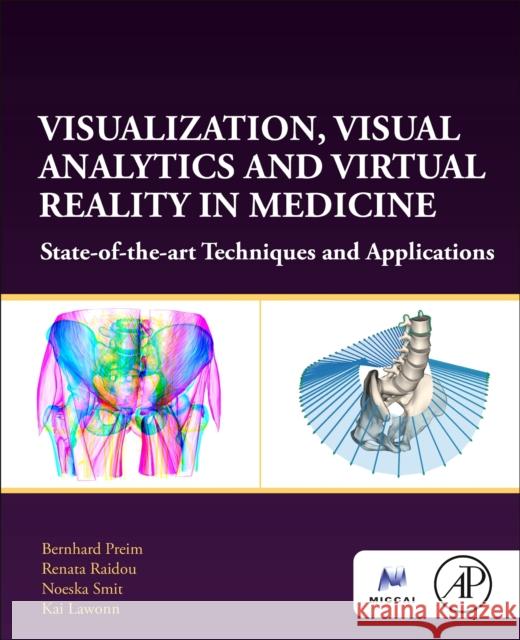 Visualization, Visual Analytics and Virtual Reality in Medicine: State-of-the-art Techniques and Applications Kai (Assistant Professor for visualization, University of Jena, Germany) Lawonn 9780128229620 Elsevier Science Publishing Co Inc