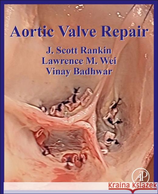 Aortic Valve Repair J. Scott Rankin 9780128230251 Academic Press