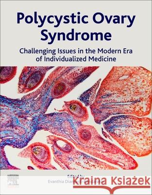 Polycystic Ovary Syndrome: Challenging Issues in the Modern Era of Individualized Medicine Evanthia Diamanti-Kandarakis 9780128230459