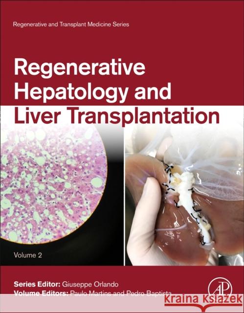 Regenerative Hepatology and Liver Transplantation: Volume 2 Martins, Paulo 9780128235249