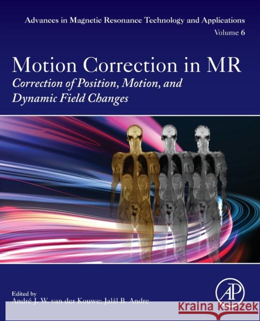 Motion Correction in MR: Correction of Position, Motion, and Dynamic Field Changes Volume 6 Van Der Kouwe, Andre 9780128244609 Academic Press