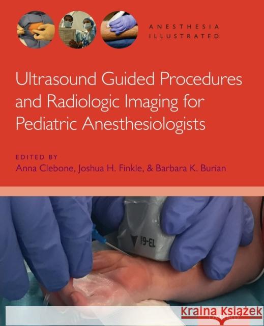 Ultrasound Guided Procedures and Radiologic Imaging for Pediatric Anesthesiologists Anna Clebone Joshua H. Finkle Keith J. Ruskin 9780190081416