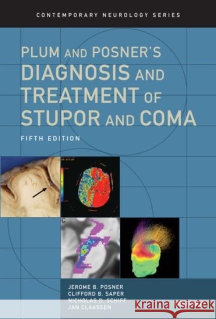 Plum and Posner's Diagnosis and Treatment of Stupor and Coma Jerome B. Posner Clifford B. Saper Nicholas D. Schiff 9780190208875