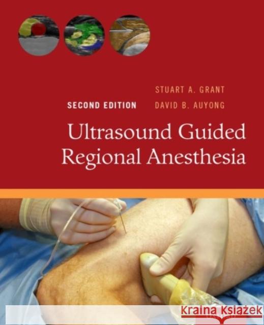 Ultrasound Guided Regional Anesthesia Stuart A. Grant David B. Auyong 9780190231804 Oxford University Press, USA