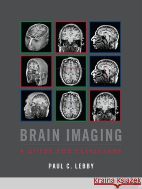 Brain Imaging: A Guide for Clinicians Paul C. Lebby 9780190239060 Oxford University Press, USA