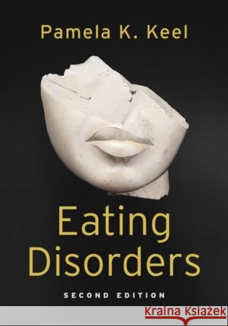 Eating Disorders Pamela K. Keel 9780190247348 Oxford University Press, USA