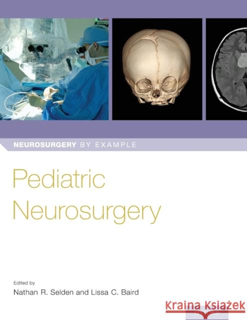 Pediatric Neurosurgery Nathan Selden Lissa Baird 9780190617073 Oxford University Press, USA