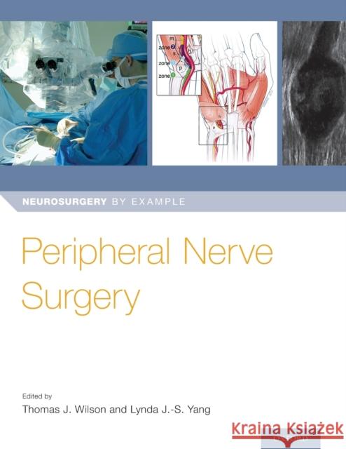 Peripheral Nerve Surgery Thomas Wilson Lynda Yang 9780190617127 Oxford University Press, USA