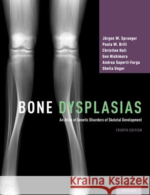 Bone Dysplasias: An Atlas of Genetic Disorders of Skeletal Development Jurgen W. Spranger Paula W. Brill Christine Hall 9780190626655