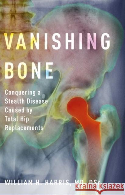 Vanishing Bone: Conquering a Stealth Disease Caused by Total Hip Replacements William H. Harris 9780190687762