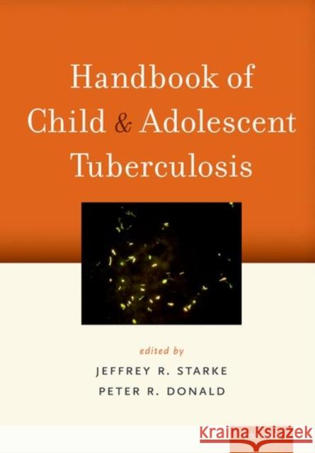 Handbook of Child and Adolescent Tuberculosis Jeffrey R. Starke Peter R. Donald 9780190695316 Oxford University Press, USA