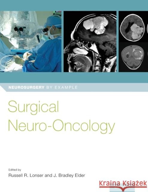 Surgical Neuro-Oncology Russell Lonser Brad Elder 9780190696696 Oxford University Press, USA