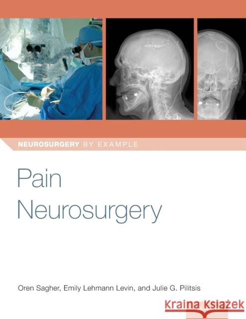 Pain Neurosurgery Oren Sagher Emily Levin Julie Pilitsis 9780190887674 Oxford University Press, USA