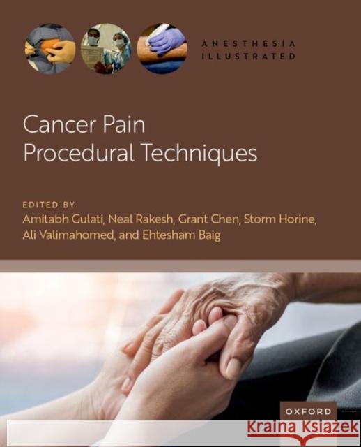 Cancer Pain Procedural Techniques Gulati 9780190933500 Oxford University Press, USA