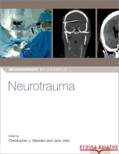 Neurotrauma Chris Madden Jack Jallo 9780190936259