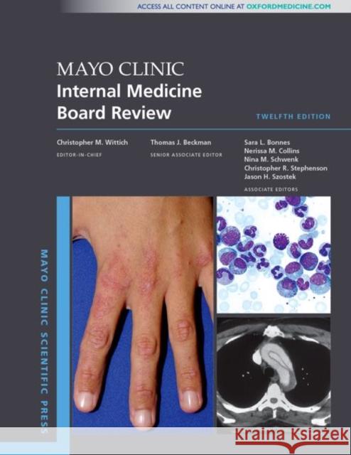 Mayo Clinic Internal Medicine Board Review Christopher M. Wittich 9780190938369 Oxford University Press, USA