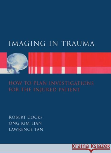 Imaging in Trauma: How to Plan Investigations for the Injured Patient Cocks, Robert 9780192625090 OXFORD UNIVERSITY PRESS