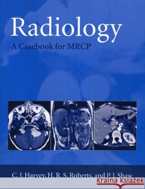 Radiology : A Case-book for MRCP  9780192629029 OXFORD UNIVERSITY PRESS