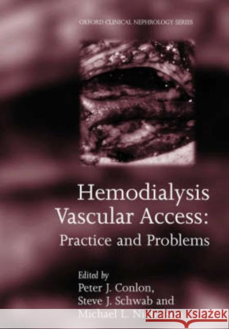 Hemodialysis Vascular Access : Practice and problems Peter J. Conlon Michael L. Nicholson Steven Schwab 9780192629425