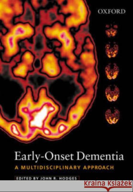 Early-Onset Dementia : A Multidisciplinary Approach John R. Hodges John Hodges 9780192630346 Oxford University Press, USA