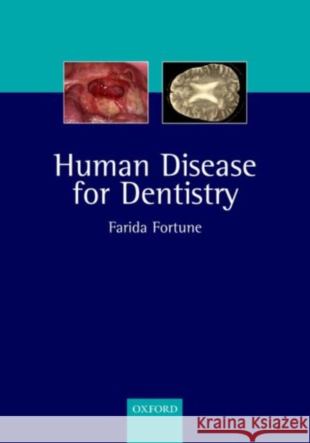 Human Disease for Dentistry Farida Fortune 9780192631633 0