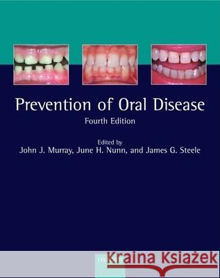 Prevention of Oral Disease John J. Murray June H. Nunn James G. Steele 9780192632791 