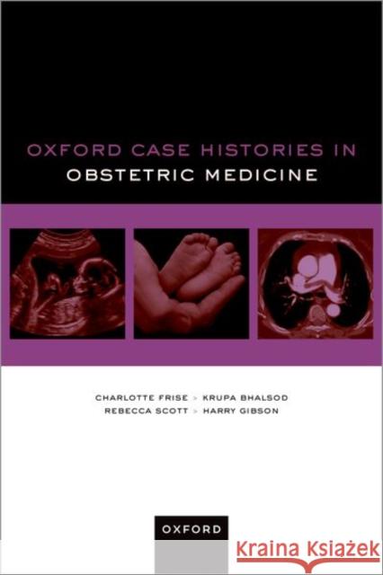 Oxford Case Histories in Obstetric Medicine Harry (Consultant in Obstetrics and Gynaecology with a specialist interest in Obstetric Medicine, Consultant in Obstetri 9780192845894 Oxford University Press