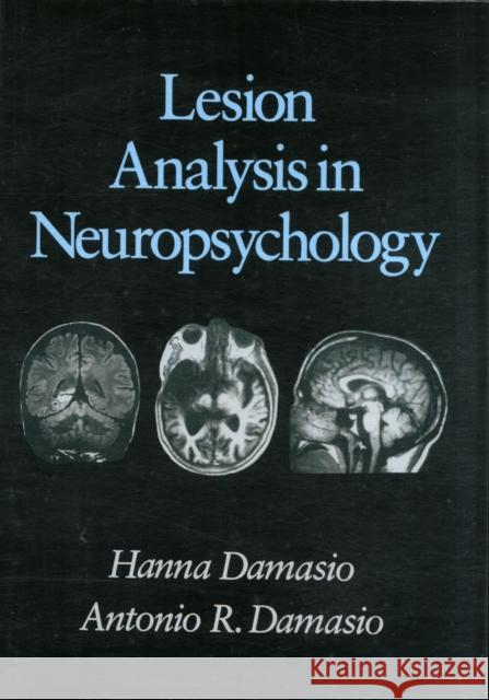 Lesion Analysis in Neuropsychology Hanna Damasio Antonio R. Damasio 9780195039191 Oxford University Press