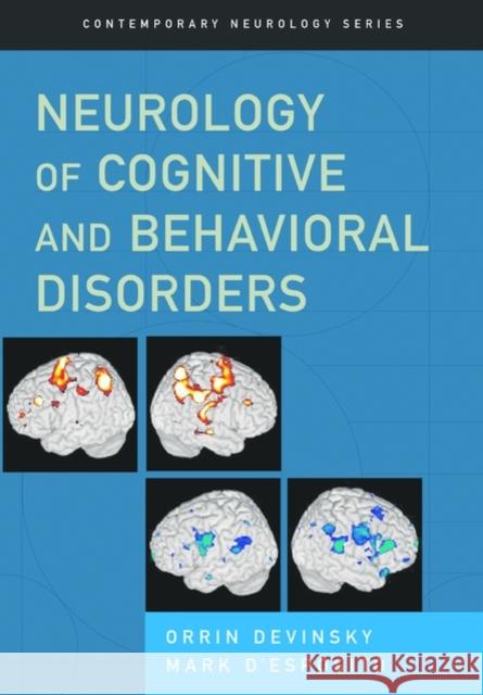 Neurology of Cognitive and Behavioral Disorders Orrin Devinsky Mark D'Esposito 9780195137644 Oxford University Press