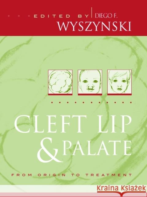 Cleft Lip and Palate: From Origin to Treatment Wyszynski, Diego F. 9780195139068 Oxford University Press, USA