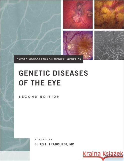 Genetic Diseases of the Eye Elias I Traboulsi 9780195326147 0