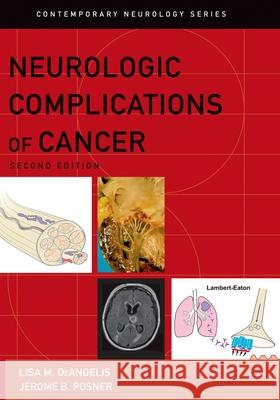 Neurologic Complications of Cancer Lisa M. Deangelis Jerome B. Posner 9780195366747