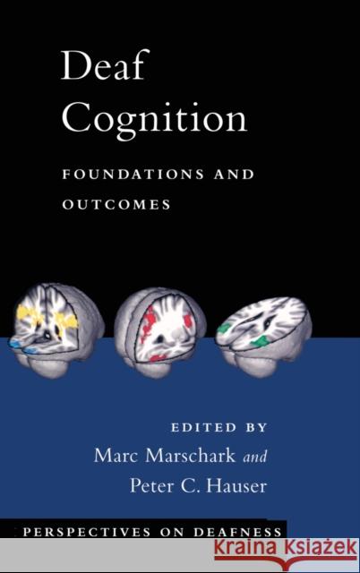 Deaf Cognition Foundat & Outcomes Pd C: Foundations and Outcomes Marschark, Marc 9780195368673 Oxford University Press, USA