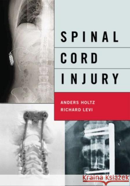 Spinal Cord Injury Anders, MD Holtz Richard, MD Levi 9780195372762 Oxford University Press, USA