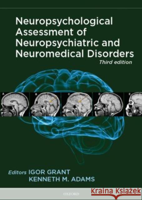 Neuropsychological Assessment of Neuropsychiatric and Neuromedical Disorders Igor, M.D. Grant Kenneth Adam 9780195378542