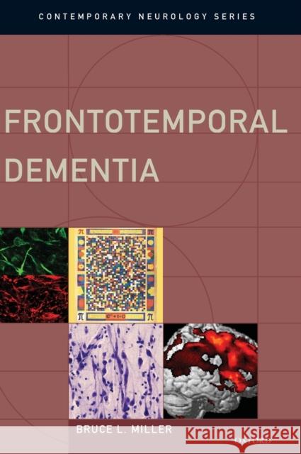 Frontotemporal Dementia Bruce L. Miller 9780195380491 Oxford University Press, USA