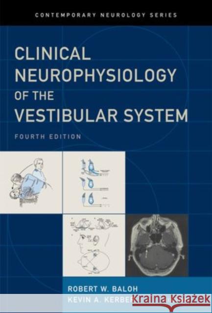 Baloh and Honrubia's Clinical Neurophysiology of the Vestibular System, Fourth Edition Baloh, Robert W.|||Kerber, Kevin 9780195387834